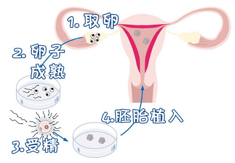 全球医疗